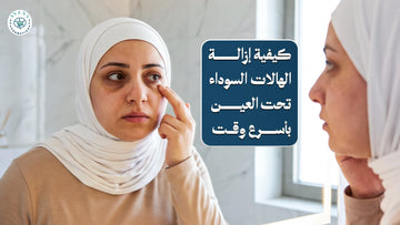 كيفية إزالة الهالات السوداء تحت العين بأسرع وقت  