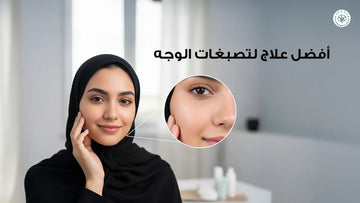 افضل علاج لتصبغات الوجه