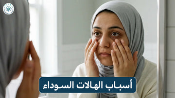 أسباب الهالات السوداء تحت العين 