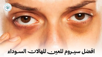 افضل سيروم للعين للهالات السوداء