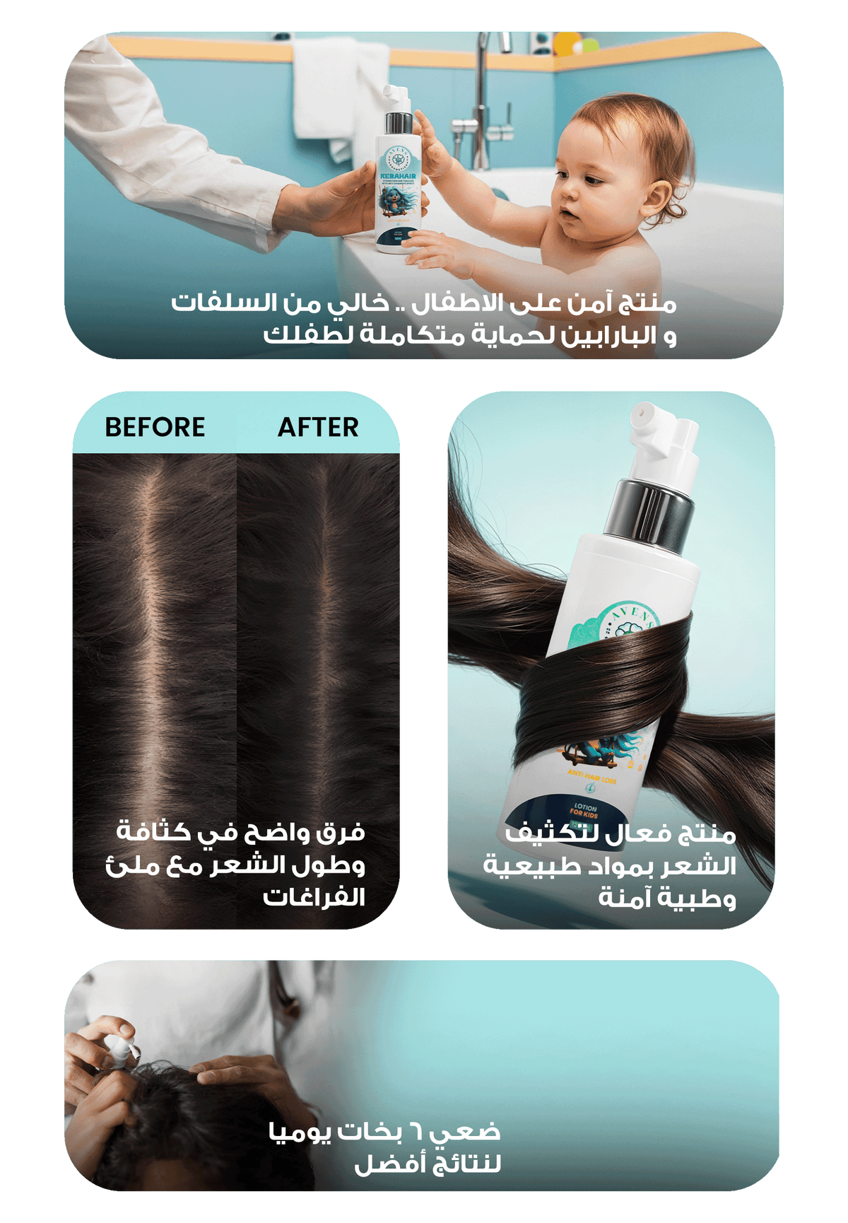 كيراهير لوشن (للأطفال)