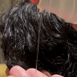 سيروم كيراهير لعلاج التقصف